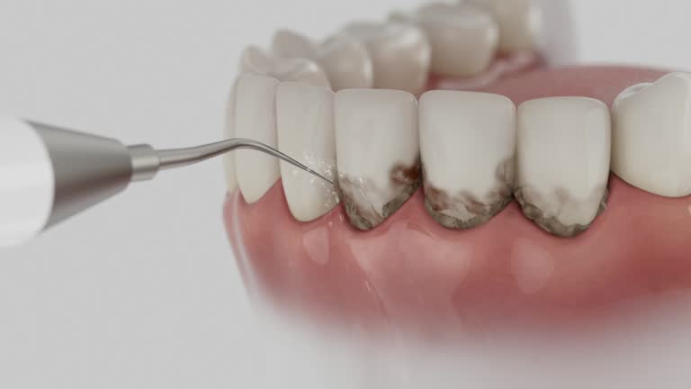 Trusted Dental Implants service in Lake Wynonah, PA - Dentist Open Now